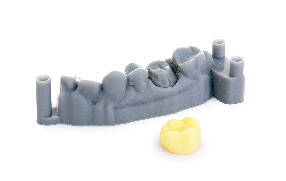 Tree Models | Prototipagem 3D em odontologia