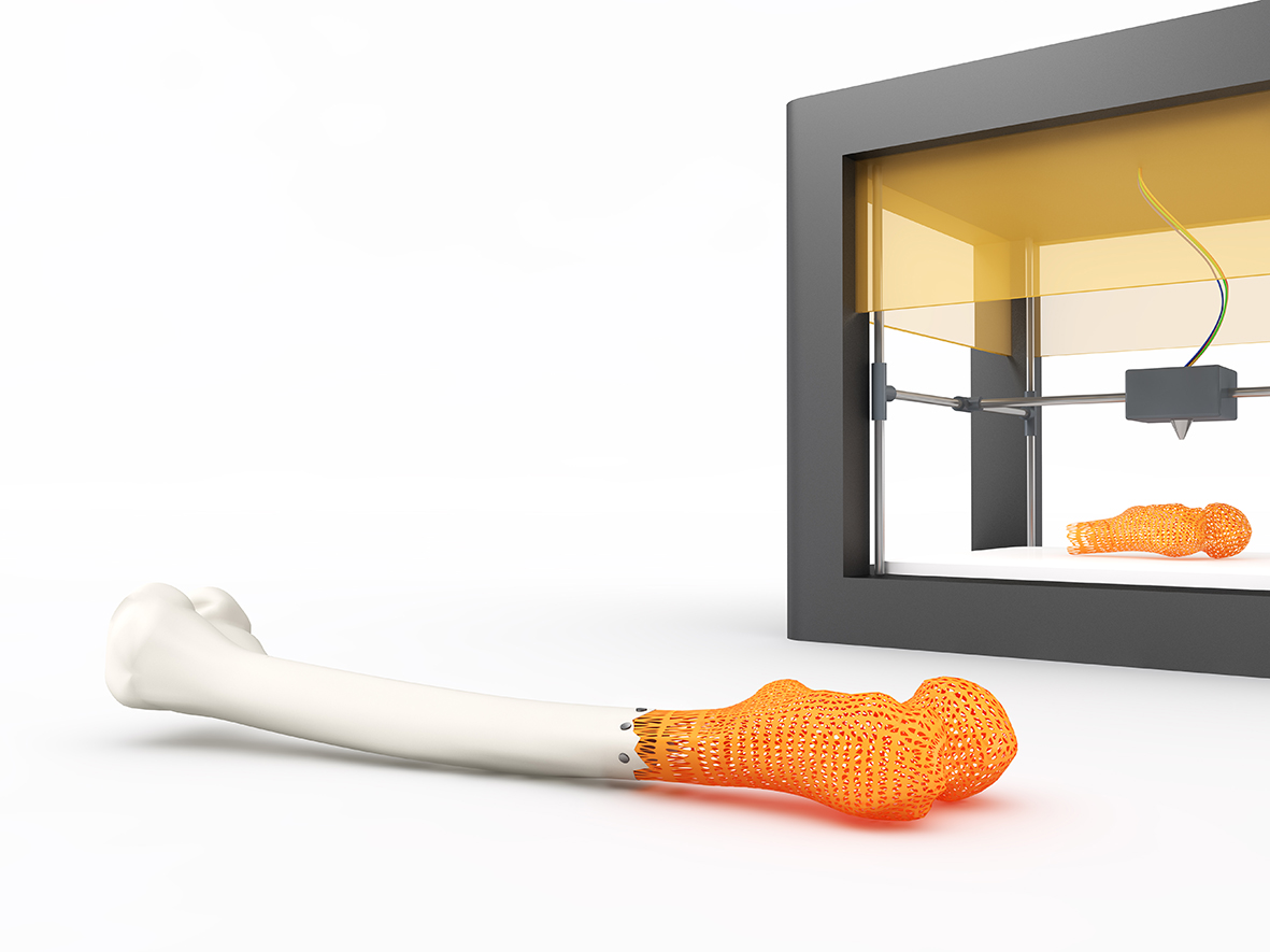 Tree Models | Impressão 3D na Medicina